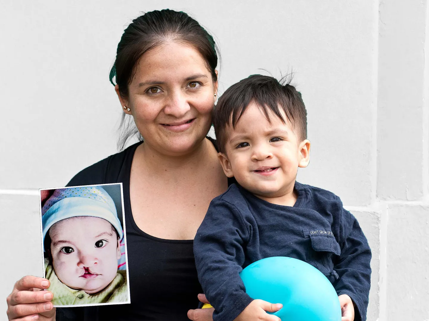 Operación sonrisa Perú