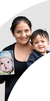formulario operación sonrisa